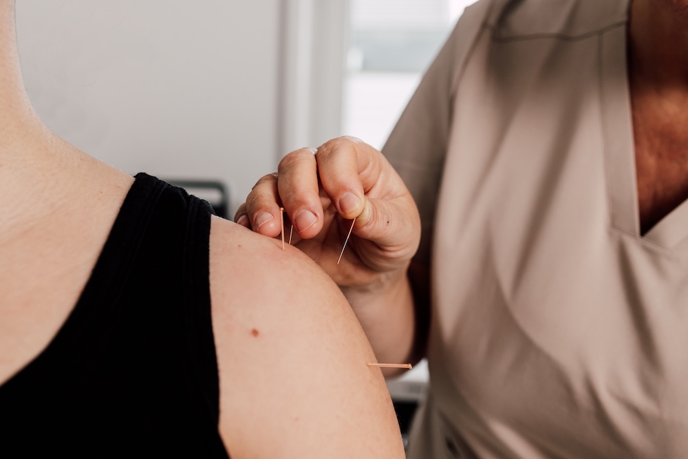 orthopaede-velbert- akupunktur